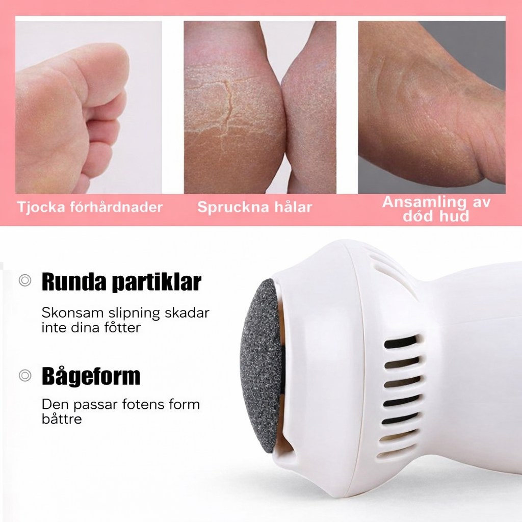 SilkStep™ – Lena och mjuka fötter på bara 60 sekunder