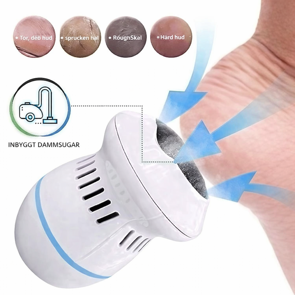 SilkStep™ – Lena och mjuka fötter på bara 60 sekunder