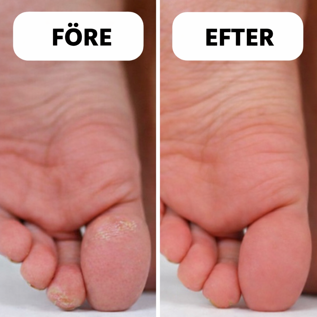 SilkStep™ – Lena och mjuka fötter på bara 60 sekunder