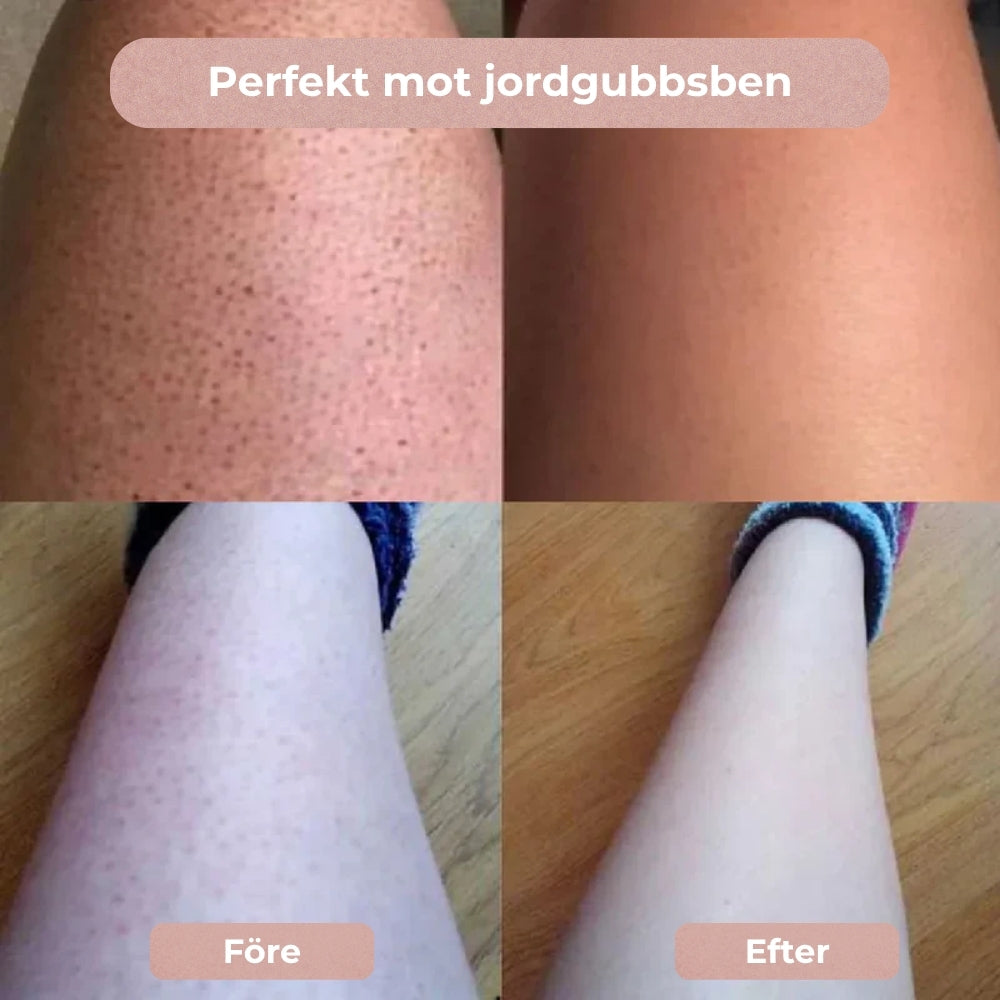 SilkeTrim™ - Skonsam 2-i-1 trimmer för perfekt hud utan irritation