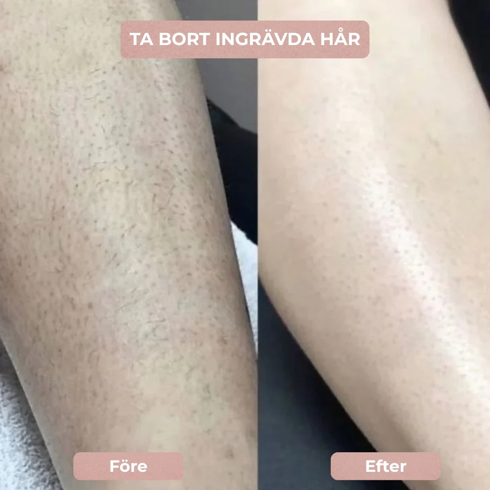 SilkeTrim™ - Skonsam 2-i-1 trimmer för perfekt hud utan irritation