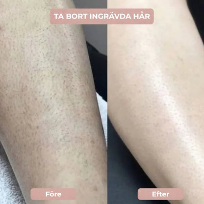 SilkeTrim™ - Skonsam 2-i-1 trimmer för perfekt hud utan irritation