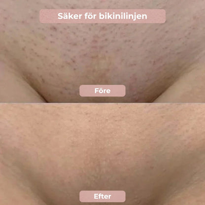 SilkeTrim™ - Skonsam 2-i-1 trimmer för perfekt hud utan irritation