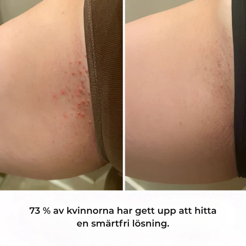 SilkeTrim™ - Skonsam 2-i-1 trimmer för perfekt hud utan irritation