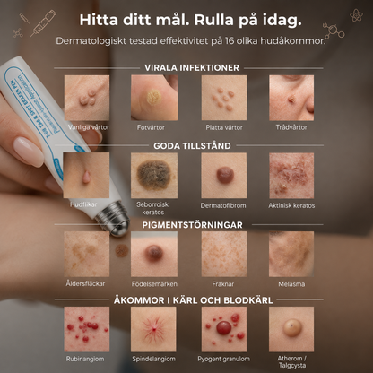 Riktad applicering för hudflikar och vårtor